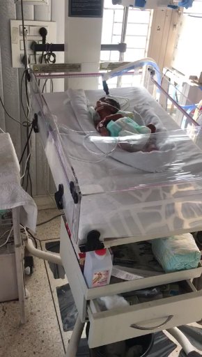 Appeal for Help:Help to save a 12 days old prematurely delivered baby