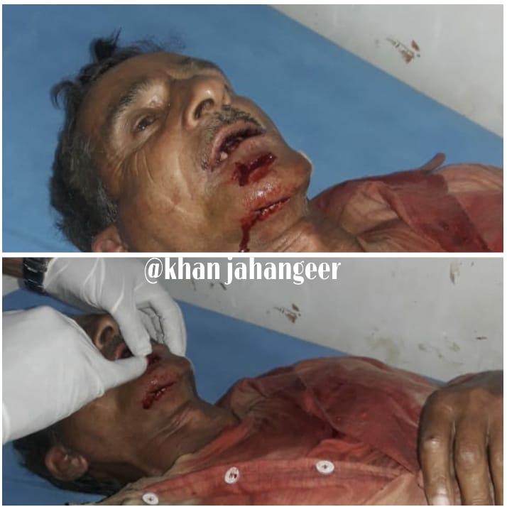 Employee of Jal Shakti department injured in Sopore