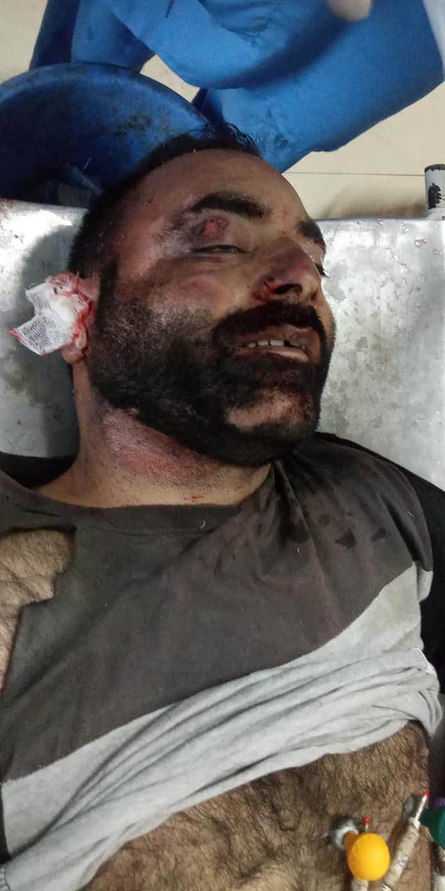 Man killed in Palhallan Baramulla Road accident