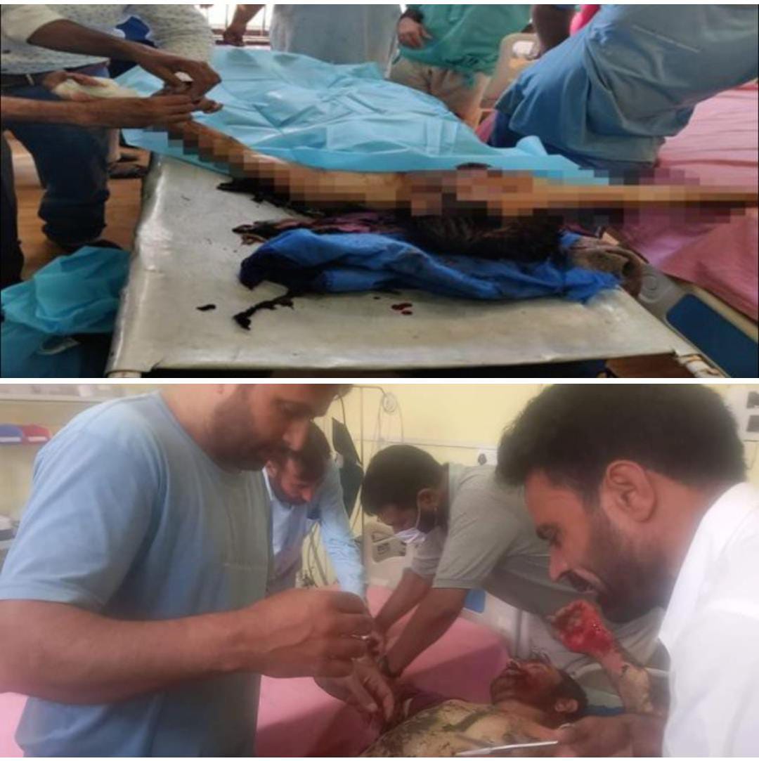 Carpenter electrocuted in Baramulla Village, hospitalized