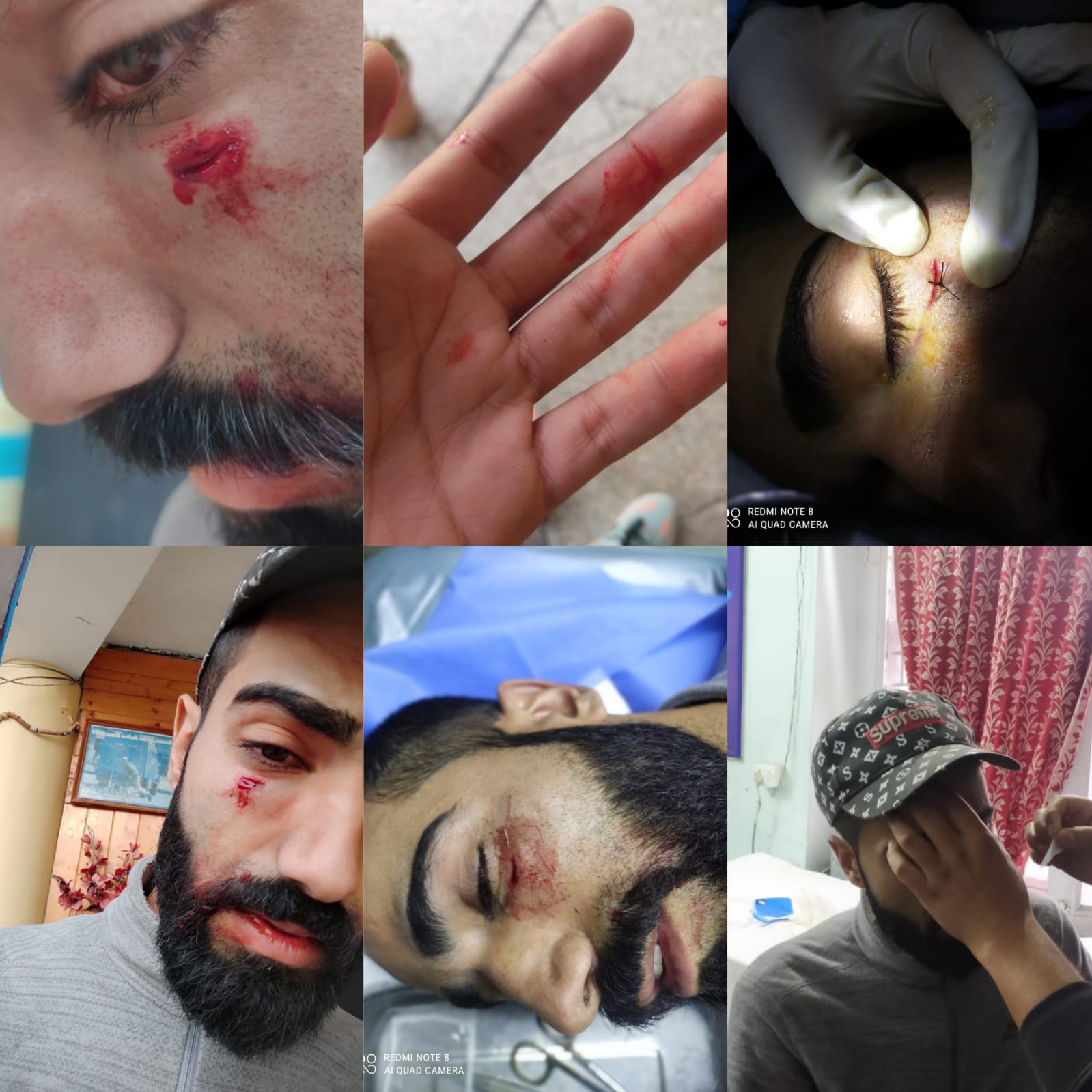 Photojournalist assaulted by Kashmir University guard